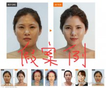 【曝光】西安施尔绮医学美容诊所-白花钱没效果，别再害人了