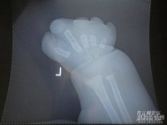 杭州艾玛妇产医院，请还孩子和我们家人健全的人生（有图有真相）