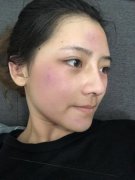 新疆天山冰川温泉水为你保驾护航